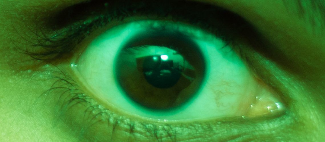 A Green eye